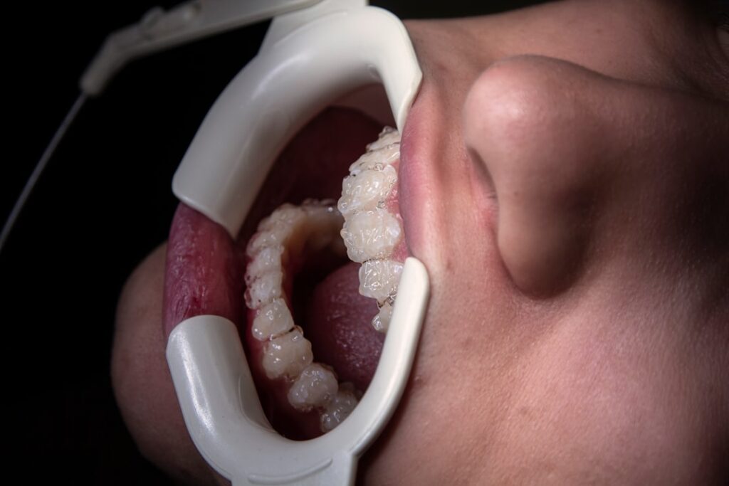 Cómo limpiar y cuidar tu férula dental para mayor durabilidad