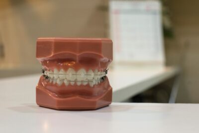 Férula de descarga y reducción del estrés: ¿qué relación existe y cómo funciona?