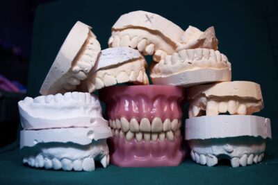 Férula dental deportiva vs. casco protector: ¿qué tan importante es cada uno para proteger dientes?