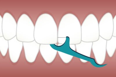 Férula dental y dolor de cabeza: ¿hay alguna relación?
