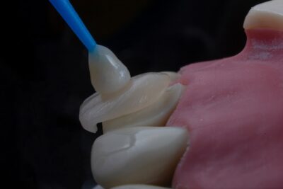 Guía para elegir una férula dental en línea de manera segura