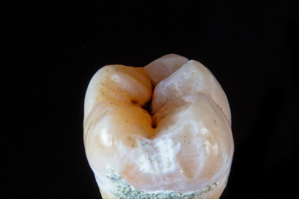 Guía paso a paso para el ajuste perfecto de tu férula dental