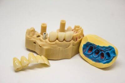 ¿Cada cuánto debería llevar mi férula dental a una limpieza profesional?