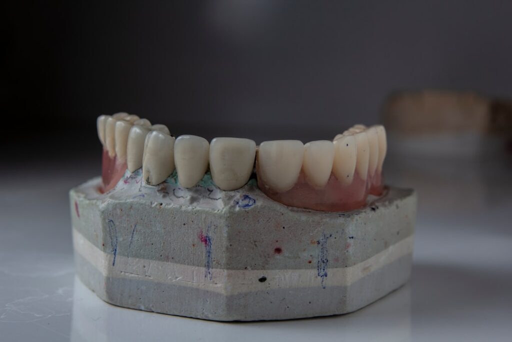 ¿Cómo afecta la precisión de las férulas personalizadas en la salud mandibular?