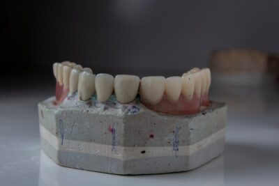¿Cómo afecta la precisión de las férulas personalizadas en la salud mandibular?