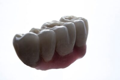 ¿Vale la pena comprar una férula dental online?